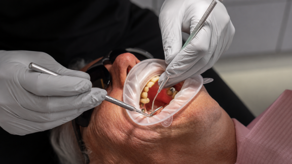 A man with his mouth wide open having his teeth checked