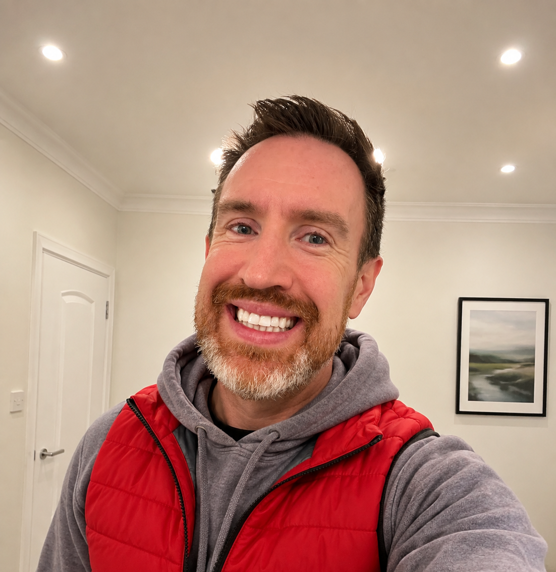 Veneers treatment image