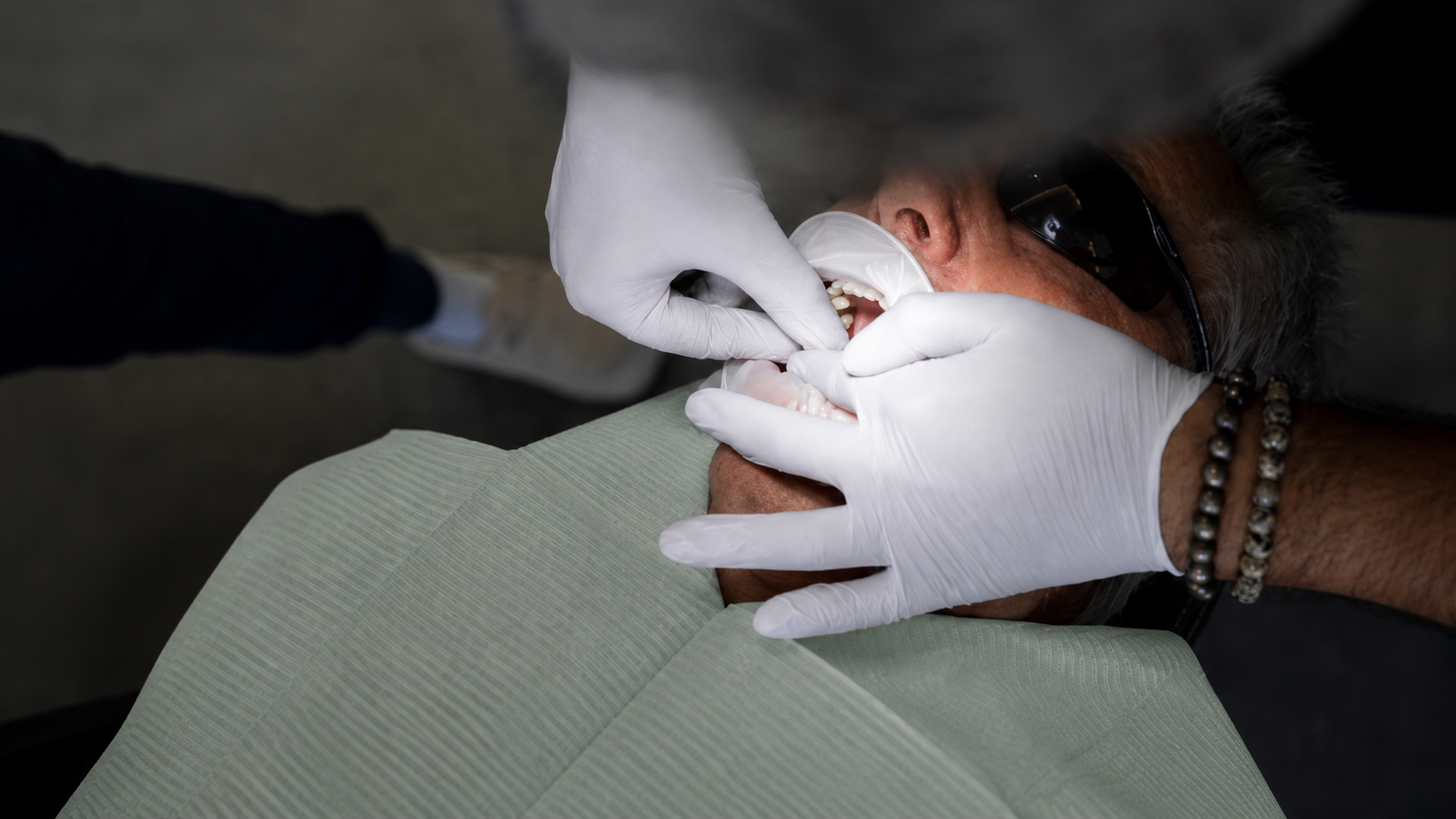 All-on-4 Implants & Teeth in a Day thumbnail image